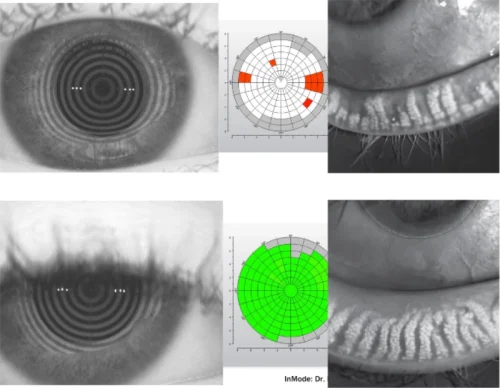 Advanced Dry Eye Treatment Center (1)