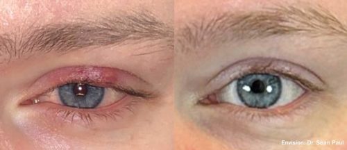 SP_Envision_Before_After_1_TM