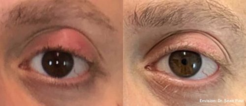 SP_Envision_Before_After_2-TM